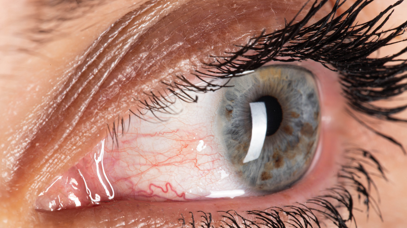 Decoding Dry Eyes: Causes, Symptoms, and Modern-day Solutions - Dr. Joseph  Cohen